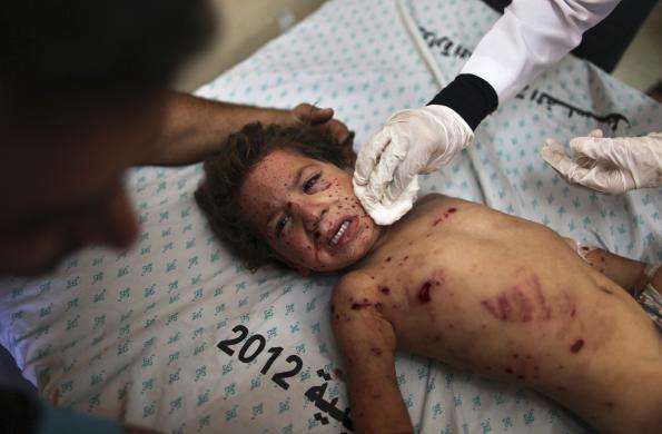 A Palestinian girl who medics said was wounded in an Israeli air strike is treated at a hospital in Khan Younis in the southern Gaza Strip July 16 2014.