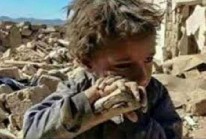 هر ۱۰ دقیقه یک کودک یمنی به دلیل جنگ می‌میرد