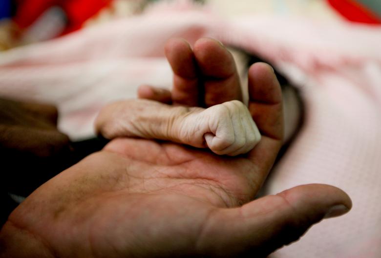 Saleh Hassan al-Faqeh holds the hand of his 4-month-old daughter, Hajar, who died at the malnutrition ward of al-Sabeen hospital in Sanaa, November 15, 2018. The war, widely seen across the region as a proxy conflict between Saudi Arabia and Iran, has be