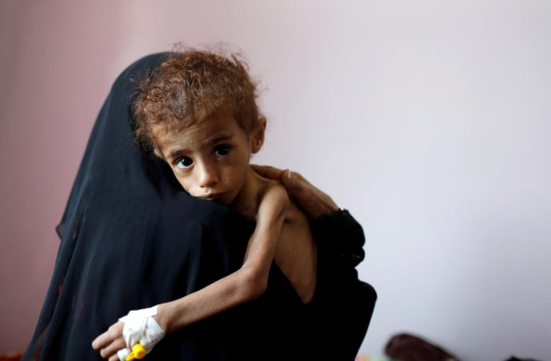A woman holds a malnourished boy in a malnutrition treatment center at the al-Sabeen hospital in Sanaa, October 6, 2018.