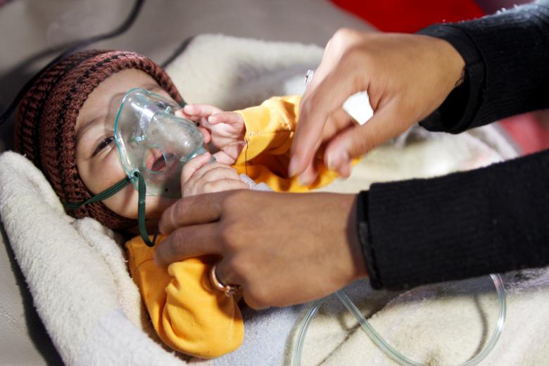 A mother holds a hand of her malnourished child at a malnutrition treatment center in Sanaa, November 22, 2018.