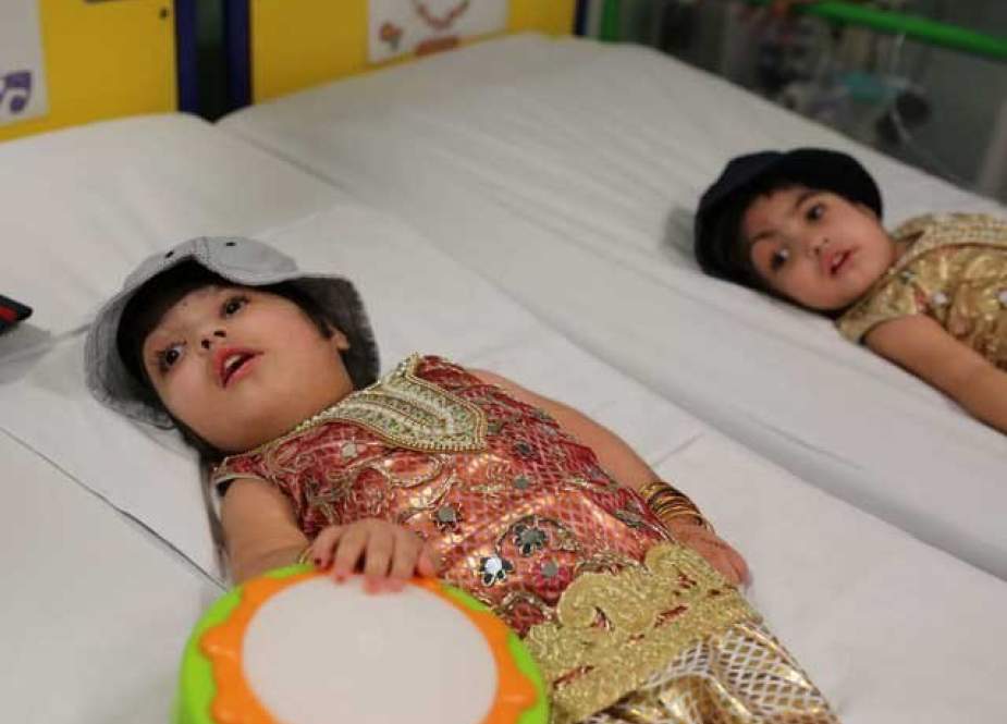 پشاور کی سرجڑی بچیوں کا برطانیہ میں 50 گھنٹے طویل کامیاب آپریشن