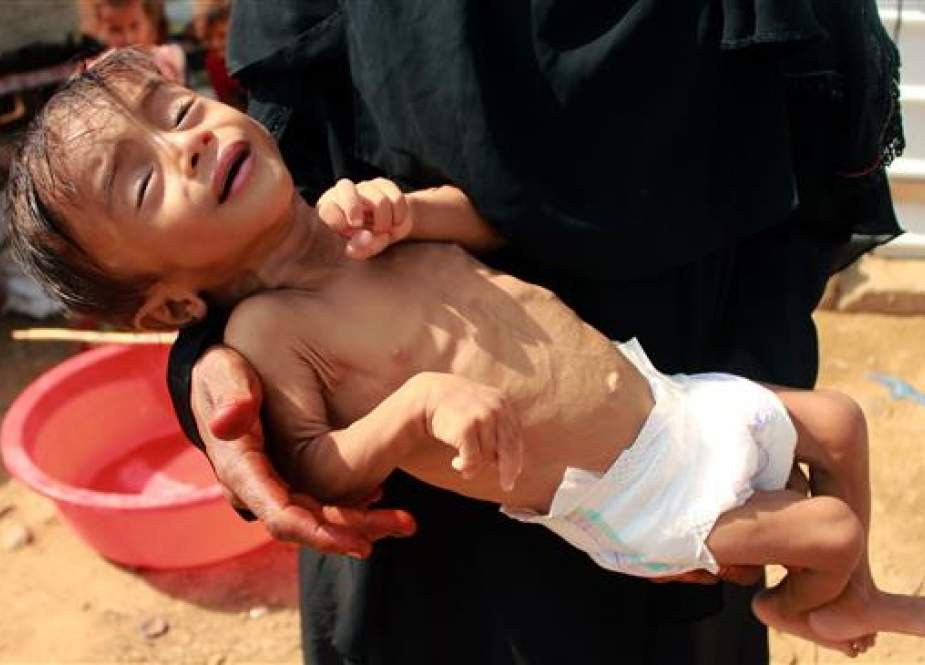 Hashem Mahmoud Atin, a ten-month-old displaced Yemeni child.jpg