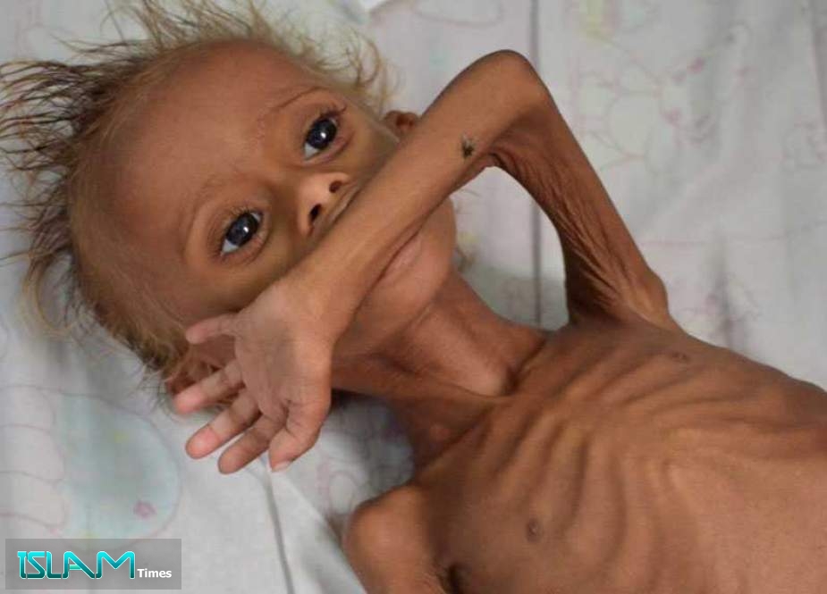 Yemen Faces World’s Worst Famine, Needs $3.85 Billion: UN Warns