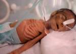 PBB: Lebih dari 19 Juta Orang Yaman Menghadapi Kelaparan
