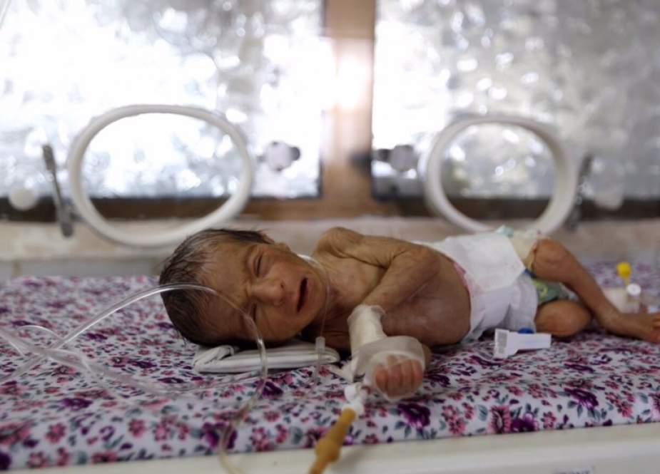 Kementerian: Lebih dari 80 Bayi Baru Lahir Yaman Meninggal Setiap Hari karena Perang yang Dipimpin Saudi