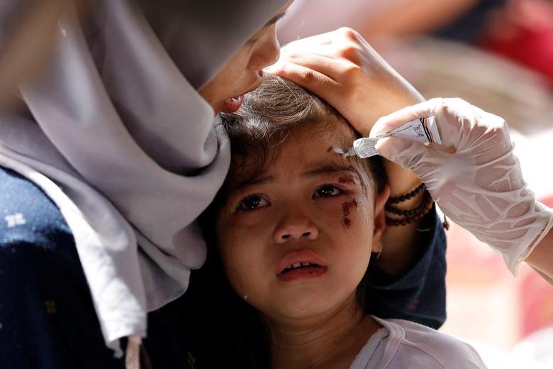 An injured girl gets treated with ointment after an earthquake in Cianjur, West Java Province, Indonesia, November 23, 2022.