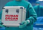 Laporan: Pertama Kali, Transplantasi Organ dari Pasien yang Meninggal Dilakukan di Iran, Timur Tengah