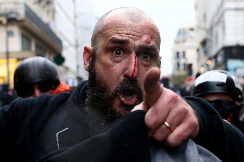 An injured man reacts during a demonstration against French government's pension reform, in Paris, France, March 23.  REUTERS/Yves Herman
