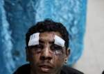 Beaten, Stripped, Used as Human Shield: Gaza Victim Recalls “Israel” Terror